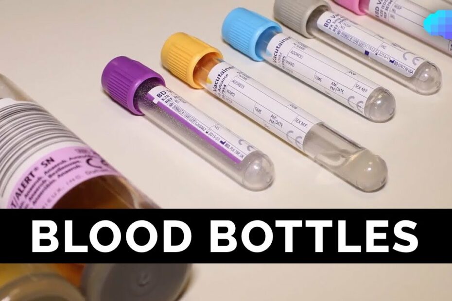 How Much Is 12 Vials Of Blood? Update