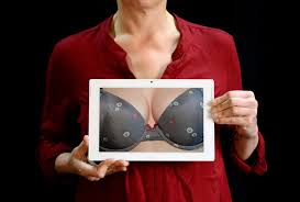 Breast Reduction Before And After In Alberta: Your Transformation Journey