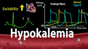 How Would An Increase In Extracellular K+ Affect Repolarization?